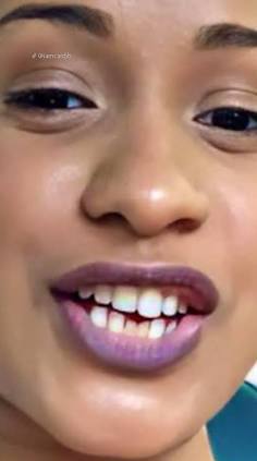 Cardi B before dental work